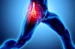 €'g髋 -开云官方网站